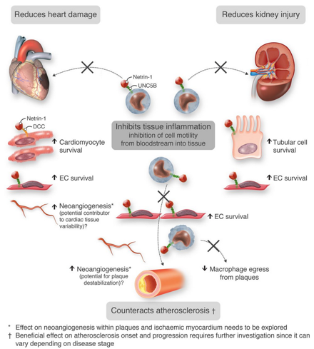 Atherosclerosis | Cardiovascular Research | Oxford Academic