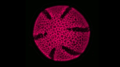 Eschscholzia californica pollen wall exine.