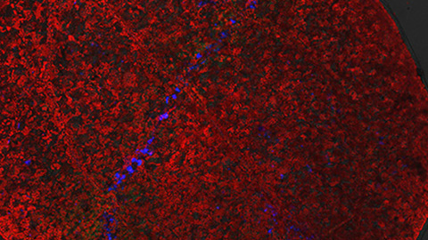 Confocal image of Arabidopsis leaf with trypan-blue staining showing progression of the Hyaloperonospora arabidopsidis downy mildew pathogen hyphae through the leaf. 