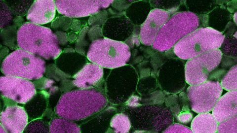 Co-localization of NO production (DAF-2 DA) and infected cells (SYTO 83) in nodules of soybean plants treated with KNO3 for 6 d.