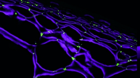 Callose immuno-localization at pit fields in tomato fruit pericarp cells.