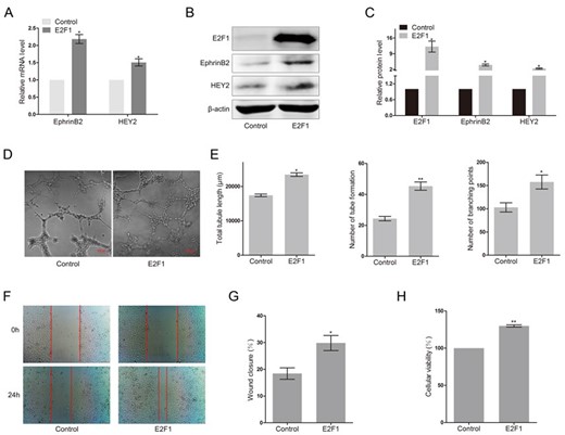 Overexpression of E2F1 upregulated the expression of arterial marker genes and promoted angiogenesis in HUAECs (A) RT-PCR analysis of EphrinB2 and HEY2 in HUAECs transfected with E2F1 or empty vector. Western blots (B) and quantification (C) of EphrinB2 and HEY2 in HUAECs transfected with E2F1 or empty vector. Matrigel assay (D) and quantification (E) of HUAECs transfected with E2F1 or empty vector. (F) Migration of HUAECs transfected with E2F1 or empty vector detected by wound healing assay. (G) Analysis of wound closure percentage. (H) Proliferation of HUAECs transfected with E2F1 or empty vector detected by MTT assay. Data were presented as the mean ± SD, n = 3. *P < 0.05, **P < 0.01.