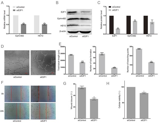 Knockdown of E2F1 decreased the expression of arterial marker genes and abolished angiogenesis in HUAECs (A) RT-PCR analysis of EphrinB2 and HEY2 in HUAECs transfected with a special siRNA targeting E2F1 (siE2F1) or non-targeting siRNA (siControl). Western blots (B) and quantification (C) of EphrinB2 and HEY2 in HUAECs transfected with siE2F1 or siControl. Matrigel assay (D) and quantification (E) of HUAECs transfected with siE2F1 or siControl. (F) Migration of HUAECs transfected with siE2F1 or siControl detected by wound healing assay. (G) Analysis of wound closure percentage. (H) Proliferation of HUAECs transfected with siE2F1 or siControl detected by MTT assay. Data were presented as the mean ± SD, n = 3.*P < 0.05, **P < 0.01.