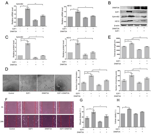 Overexpression of DNMT3A suppressed E2F1-induced expression of EphrinB2 and HEY2 and inhibited angiogenesis in HUAECs (A) RT-PCR analysis of EphrinB2 and HEY2 in HUAECs co-transfected with vector, E2F1 and/or DNMT3A. Western blots (B) and quantification (C) of EphrinB2 and HEY2 in HUAECs co-transfected with vector, E2F1 and/or DNMT3A. Matrigel assay (D) and quantification (E) of HUAECs co-transfected with vector, E2F1 and/or DNMT3A. (F) Migration of HUAECs co-transfected with vector, E2F1 and/or DNMT3A detected by wound healing assay. (G) Analysis of wound closure percentage. (H) Proliferation of HUAECs co-transfected with vector, E2F1 and/or DNMT3A detected by MTT assay. Data were presented as the mean ± SD, n = 3. *P < 0.05, **P < 0.01.