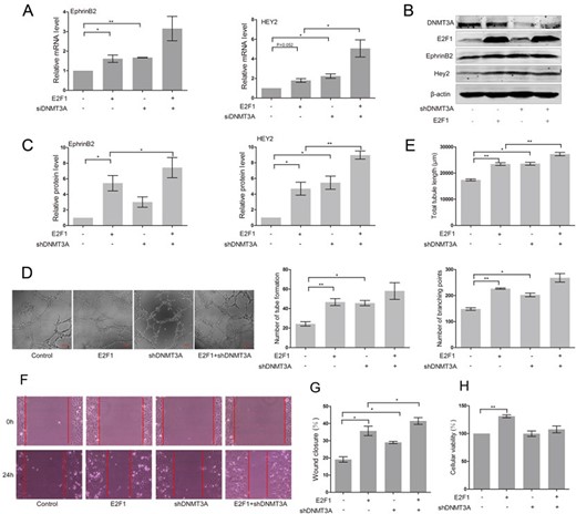 Knockdown of DNMT3A enhanced the expression of EphrinB2 and HEY2 and stimulated angiogenesis in E2F1-expressing HUAECs (A) RT-PCR analysis of EphrinB2 and HEY2 in E2F1-expressing HUAECs co-transfected with DNMT3A siRNA or control siRNA. Western blots (B) and quantification (C) of EphrinB2 and HEY2 in E2F1-expressing HUAECs co-transfected with non-targeting shRNA vector or DNMT3A targeting shRNA. Matrigel assay (D) and quantification (E) of E2F1-expressing HUAECs co-transfected with non-targeting shRNA vector or DNMT3A targeting shRNA. (F) Migration of E2F1-expressing HUAECs co-transfected with non-targeting shRNA vector or DNMT3A targeting shRNA detected by wound healing assay. (G) Analysis of wound closure percentage. (H) Proliferation of E2F1-expressing HUAECs co-transfected with non-targeting shRNA vector or DNMT3A targeting shRNA detected by MTT assay. Data were presented as the mean ± SD, n = 3. *P < 0.05, **P < 0.01.
