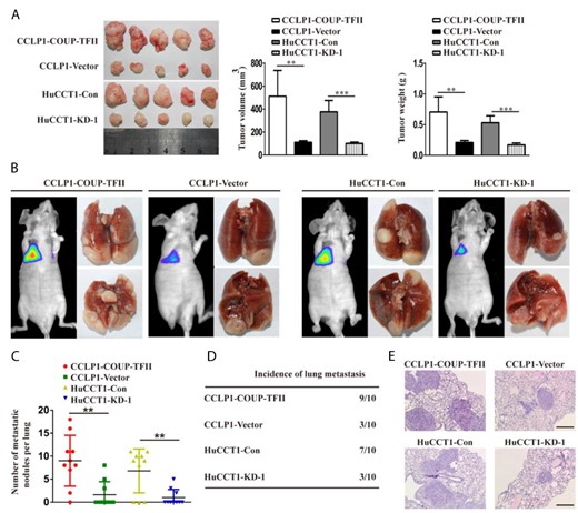 COUP-TFII promotes the growth and metastasis of ICC in vivo (A) COUP-TFII upregulation enhanced CCLP1 cell xenograft tumor growth in nude mice, while COUP-TFII knockdown reduced HuCCT1 growth. (B) Lung metastasis models were established as described in the “Materials and Methods”. Representative bioluminescence images and gross specimens shown for the indicated cell lines. (C) Histogram showing the number of metastatic nodules in the different groups. (D) Incidence data of lung metastasis in the different groups. (E) Images showing representative hematoxylin and eosin staining of lung tissue samples from the different groups. Scale bar: 100 μm. Data are expressed as the mean ± SD. The results are representative of three independent experiments. **P < 0.01, ***P < 0.001.