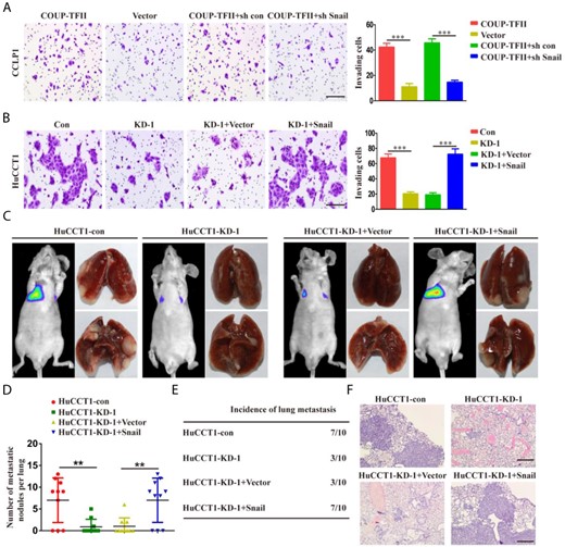 COUP-TFII promotes ICC invasion and metastasis by increasing Snail expression (A) After CCLP1-COUP-TFII cells were infected with LV-sh con or LV-sh Snail, invasion abilities of the cells were detected by transwell assays. (B) After HuCCT1-KD-1 cells were infected with the LV-Vector or LV-Snail, invasion abilities of the cells were detected by transwell assays. (C) Luciferase-expressing cell lines (HuCCT1-sh COUP-TFII, HuCCT1-sh COUP-TFII plus Snai1, and their control cells) were injected via the tail vein into the nude mice. Representative bioluminescence images and gross specimens shown for the indicated cell lines. (D) Histogram showing the number of metastatic nodules in the different groups. (E) Incidence data of lung metastasis in the different groups. (F) Images showing representative hematoxylin and eosin staining of lung tissue samples from the different experimental groups. Scale bar: 100 μm. Data are expressed as the mean ± SD. The results are representative of three independent experiments. **P < 0.01, ***P < 0.001.