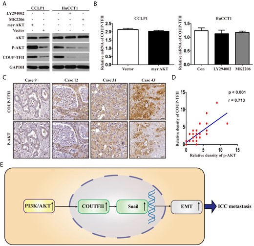 Regulation of COUP-TFII protein level by PI3K/AKT signaling pathway (A,B) After activation or inhibition of PI3K/AKT signaling pathway through ectopic expression of active myr-AKT plasmid or administration of LY294002 or MK2206, the protein and mRNA expressions of COUP-TFII were detected. (C, D) Relative protein densities of COUP-TFII and p-AKT in ICC tissues were shown. COUP-TFII overexpression was significantly positively correlated with p-AKT upregulation in human ICC tissues. (E) Schematic presentation of the mechanism underlying COUP-TFII-facilitated ICC metastasis. Data are expressed as the mean ± SD. The results are representative of three independent experiments.