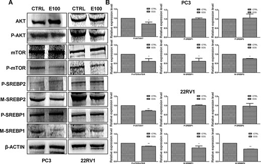 ECG inhibited PI3K/AKT/mTOR signaling pathway and the maturation of SREBPs (A) Western blot analysis was performed to evaluate the effects of ECG. (B) Quantitative results of the western blots. *P < 0.05, **P < 0.01.