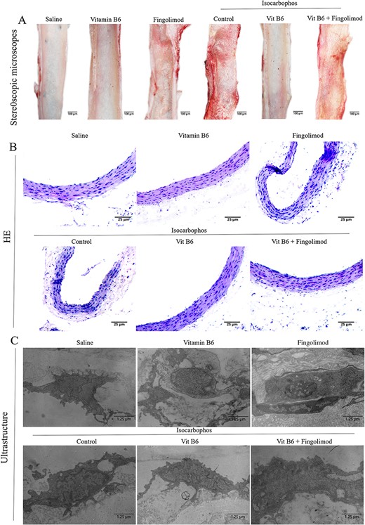 Injury analysis of posterior cerebral artery (A) Optical images of endothelial structure of posterior cerebral artery in offspring rats. (B) H&E staining images of posterior cerebral artery in offspring rats after different treatments. (C) Electron microscopy images of vascular endothelium of posterior cerebral artery in offspring rats.