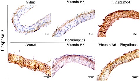 Expression of Caspase-3 in the posterior cerebral arteries of offspring rats in different treatment groups