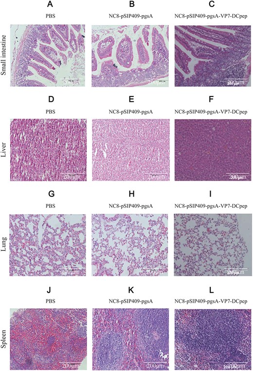 Histopathological changes in mice infected with the DN30209 Chinese PRV isolate strain following immunization (A–C) Small intestine. (D–F) Liver. (G–I) Lung. (J–L) Spleen. A, D, G, and J represent mice treated with PBS; B, E, H, and K represent mice immunized with empty vector; and C, F, I, and L represent mice immunized with recombinant NC8-pSIP409-pgsA-VP7-DCpep.