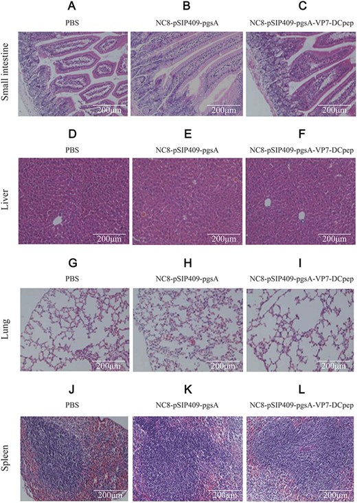 Pathological changes in mouse induced by recombinant NC8-pSIP409-pgsA-VP7-DCpep revealed by HE staining (A–C) Small intestine. (D–F) Liver. (G–I) Lung. (J–L) Spleen. A, D, G, and J represent mice treated with PBS; B, E, H, and K represent mice immunized with empty vector; and C, F, I, and L represent mice immunized with recombinant NC8-pSIP409-pgsA-VP7-DCpep. Scale bar: 200 μm.