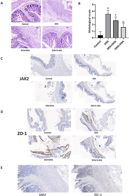 Effect of DHA on the colons in DSS-induced colitis in vivo (A) Representative H&E staining images of the colon sections from different groups. Scale bar: 200 μm. (B) Histology scores of different groups. (C) Immunohistochemical staining of JAK2 in colon sections from four groups of mice. (D) Immunohistochemical ZO-1 staining of in colon sections from four groups of mice. (E) Immunohistochemical staining of ZO-1 and JAK2 in colon biopsies of clinical IBD patients. Data are presented as the mean±SD. **P<0.01 vs control group. #P<0.05, ##P<0.01 vs DSS group. n = 5.