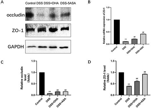 Effect of DHA on tight junction proteins in mice colon tissue in DSS-induced colitis (A) Western blot analysis of ZO-1 and occludin protein expressions. (B) Relative expression of ZO-1 mRNA in the four groups of mice colon tissue homogenates. (C,D) Quantitative analysis of ZO-1 and occludin proteins. Data are presented as the mean±SD. **P<0.01 vs control group. ##P<0.01 vs DSS group.