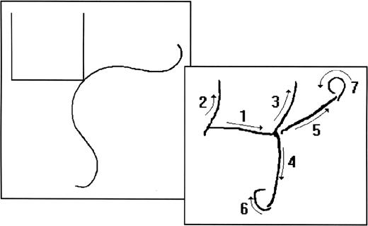 Sequence of copying (right) of a Bender drawing (left).