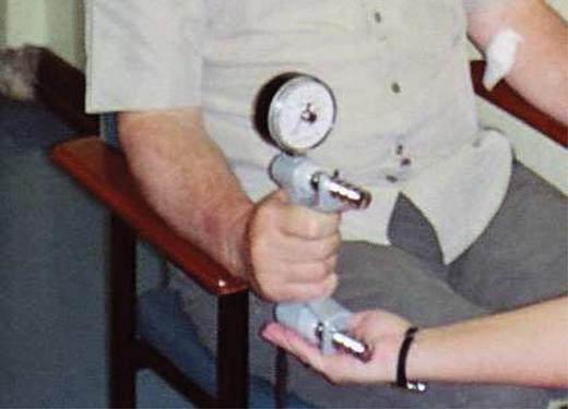 Southampton protocol for adult grip strength measurement.
(1) Sit the participant comfortably in a standard chair with legs, back support and fixed arms. Use the same chair for every measurement. (2) Ask them to rest their forearms on the arms of the chair with their wrist just over the end of the arm of the chair—wrist in a neutral position, thumb facing upwards. (3) Demonstrate how to use the Jamar handgrip dynamometer to show that gripping very tightly registers the best score. (4) Start with the right hand. (5) Position the hand so that the thumb is round one side of the handle and the four fingers are around the other side. The instrument should feel comfortable in the hand. Alter the position of the handle if necessary. (6) The observer should rest the base of the dynamometer on the palm of their hand as the subject holds the dynamometer. The aim of this is to support the weight of the dynamometer (to negate the effect of gravity on peak strength), but care should be taken not to restrict its movement. (7) Encourage the participant to squeeze as long and as tightly as possible or until the needle stops rising. Once the needle stops rising the participant can be instructed to stop squeezing. (8) Read grip strength in kilograms from the outside dial and record the result to the nearest 1 kg on the data entry form. (9) Repeat measurement in the left hand. (10) Do two further measurements for each hand alternating sides to give three readings in total for each side. (11) The best of the six grip strength measurements is used in statistical analyses so as to encourage the subjects to get as high a score as possible. (12) Also record hand dominance, i.e. right, left or ambidextrous (people who can genuinely write with both hands). Equipment: Model J00105 JAMAR Hydraulic Hand Dynamometer.