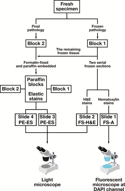 Flow chart of the procedures for diagnosis visceral pleural invasion. Slides 1 and 2 were cut from frozen tissue intraoperatively; slides 3 and 4 were cut from paraffin-embedded tissue. Slides 1, 2, and 3 were cut from the same block (block 1); slide 4 was cut from block 2. DAPI, 4′,6-diamidino-2-phenylindole; FS-A, frozen section autofluorescence; FS-H&E, frozen section H&E staining; PE-ES, paraffin-embedded tissue section elastic staining.
