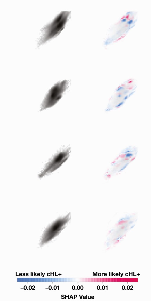 Example Shapley additive explanation (SHAP) value plots for individual flow cytometry cases. Images on the left are the two-dimensional histograms for CD40 (x-axes) vs CD15 (y-axes). Images on the right show the corresponding SHAP values in red and blue, with red more predictive of Hodgkin lymphoma. A light-gray background that depicts the original histogram is also included in right panels for context in the images on the right. Examples were chosen from cases with predicted cHL+ probability more than 0.95. cHL, classic Hodgkin lymphoma.