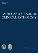 dna typing of the human mn and ss blood group antigens in amniotic