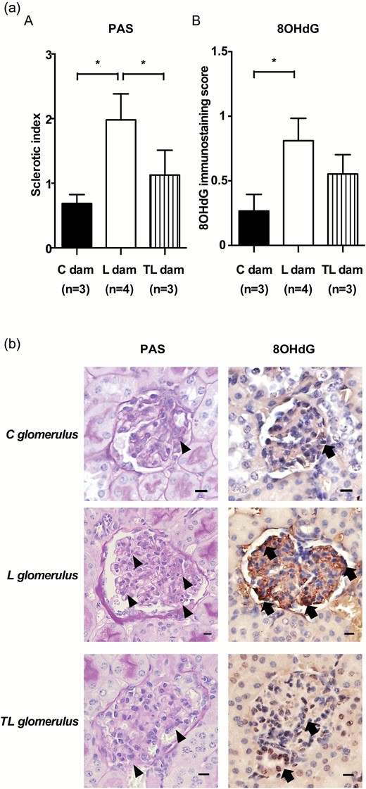 Histological analysis of the kidney. (a) (A) The sclerotic index of the glomerulus and (B) the glomerular 8-OHdG immunostaining score of C dams (n = 3), L dams (n = 4), and TL dams (n = 4). Asterisks show statistically significant differences (P < 0.05) between groups indicated by square brackets as determined by 1-way ANOVA followed by Bonferroni’s post-hoc test. (b) PAS staining and 8OHdG immunostaining images of the glomerulus. 8-OHdG expression (arrows) was prominent in the glomerulus of L dams (arrow heads indicate glomerular sclerosis; sclerotic index score = 3), but it was weak in the glomerulus of C dams (sclerotic index score = 1) and TL dams (sclerotic index score = 1). Scale bars: 10 µm. C glomerulus: glomerulus in the kidney of C dams. L glomerulus: glomerulus in the kidney of L dams. TL glomerulus: glomerulus in the kidney of TL dams. Nuclei were counterstained with hematoxylin. Abbreviation: ANOVA, analysis of variance;