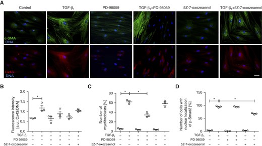 ERK1/2- and TAK1-dependent signaling play secondary roles in the regulation of Cx43 expression and FMT in populations of AS HBFs. (A) AS HBFs were cultivated in control conditions or in DMEM supplemented with TGF-β1 (5 ng/ml) in the presence or absence of PD98059 (20 μM) and 5Z-7-oxozeaenol (10 μM). Subsequently, the cells were immunostained for Cx43, α-SMA, p-Smad2, and DNA (blue). (B) Cx43 levels in AS HBFs were quantified with the fluorometric approach. Alternatively, relative numbers of (C) cells that had formed abundant α-SMApositive stress fibers and of (D) p-Smad2positive nuclei were quantified with fluorescence microscopy. Bars represent the mean values (±SEM). P values were calculated with one-way analysis of variance and post hoc Bonferroni multiple comparison test (versus TGF-β+); *P ≤ 0.05. Scale bar: 25 μm. All results are representative of three independent experiments. Note that ERK1/2 inhibition by PD98059 attenuates FMT and slightly inhibits TGF-β1–induced Cx43 up-regulation in the absence of any effects on Smad2 activation. The inhibition of TAK1 by 5Z-7-oxozeaenol does not affect FMT and Cx43 up-regulation, although it slightly reduces relative numbers of p-Smad2positive nuclei in TGF-β1–treated AS HBFs.