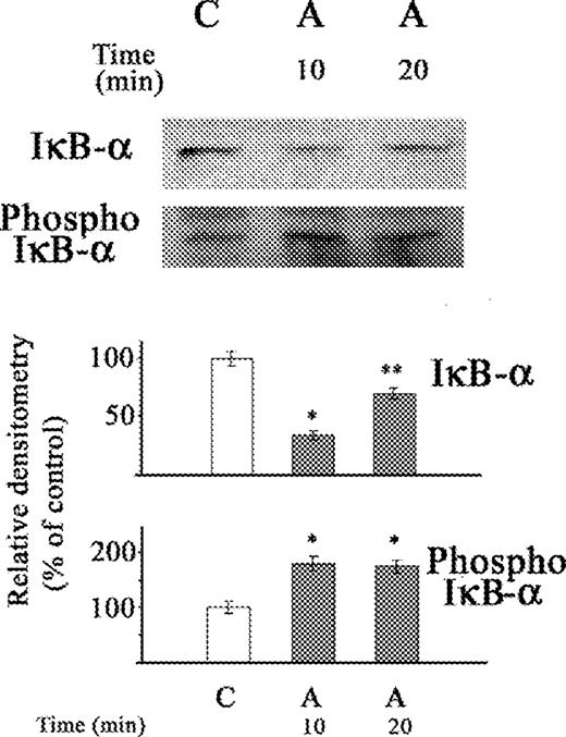 Western blot of the effect of acetaldehyde (A) on IκB-α protein and phosphorylated IκB-α in cytosolic extract of stellate cells. The cells were not exposed (C) or exposed to acetaldehyde (A) (200 μM) for 10 and 20 min. The relative densitometry readings (mean ± SE) from three samples for each determination are shown. *P < 0.05 vs respective control. *P < 0.05 vs respective group.