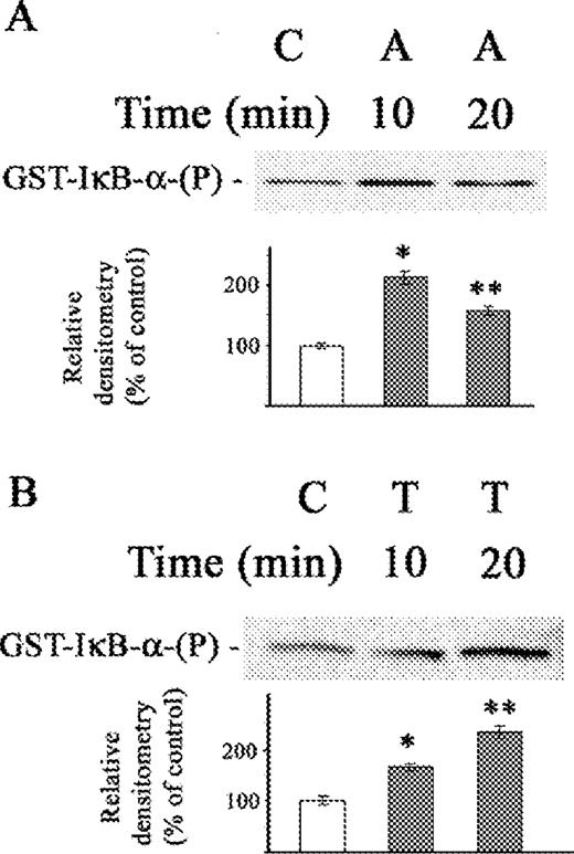 Effect of acetaldehyde (A) and TNFα (B) on IκB-α kinase activity in stellate cells of rat. Cytosol was precipitated with antibody to IKK-α. The kinase assay used GST-IκB-α as a substrate and [γ32-ATP]. The changes in 32P phosphorylated GST-IκB-α are shown. The cells were not exposed (C) or exposed to acetaldehyde (A) (200 μM) (A) or to TNFα (T) (0.6 nM) (B) for 10 and 20 min. The relative densitometry readings (mean ± SE) from three samples for each determination are shown. *P < 0.05 vs respective control.