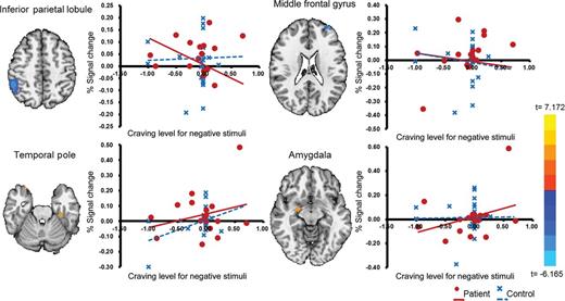 Interactions between group and craving responsivity to negative emotional stimuli. As craving responsivity increased in the patient group, activation of the right inferior parietal lobule and the left dorsolateral prefrontal cortex decreased and activation of limbic region increased.