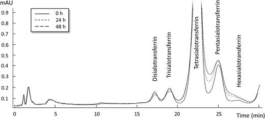 HPLC chromatographic changes of the iron-saturated transferrin glycoform pattern at 470 nm following incubation of a serum sample at 37°C with 20 mmol/l glucose at baseline (0 h) and after 24 h and 48 h.