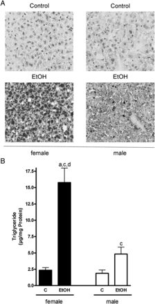 Effect of acute alcohol treatment on hepatic lipid accumulation. (A) Representative photomicrographs of the Oil Red O staining (×400) of livers of female and male control mice and mice treated with alcohol and (B) quantification of the hepatic triglyceride levels. Data are shown as means ± SEM (female: n = 9, male: n = 6). aP < 0.05 vs. female C, cP < 0.05 vs. male C, dP < 0.05 vs. male EtOH. C, control mice, EtOH, ethanol-treated mice (6 g EtOH/kg body weight).