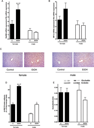 Effect of acute alcohol treatment on TLR-4 signaling cascade, hepatic lipid peroxidation and intestinal permeability. Relative hepatic mRNA expression of (A) MyD88, (B) IRF-3, both normalized to 18 s mRNA expression, (C) representative photomicrographs of immunostaining of 4-HNE protein adducts (×400), (D) densitometric analysis of 4-HNE adduct staining in liver sections and (E) densitometric analysis of occludin western blot in the duodenum of female and male control mice and mice treated with alcohol. Data are shown as means ± SEM (female: n = 6–9, C male: n = 4–6). aP < 0.05 vs. female C, cP < 0.05 vs. male C, dP < 0.05 vs. male EtOH. C, control mice, EtOH, ethanol-treated mice (6 g EtOH/kg body weight).