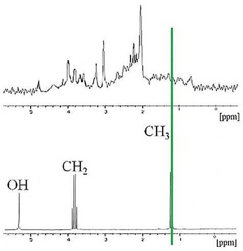 1HMRS of the human brain (top) and 1HMRS of ethanol (bottom).