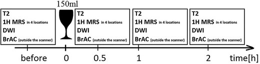Schematic diagram of the study procedure: T2, 1HMRS and DWI were performed before, 30 minutes, 60 minutes and 120 minutes after drinking of 150 mL of alcohol; concentration of ethanol in exhaled breath (BrAC) was also measured.
