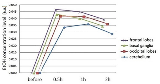 Comparison of changes in ethanol concentrations in various brain regions, in frontal lobes (x), basal ganglia (▲), occipital lobes (□) and cerebellum (◊).