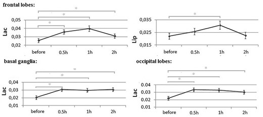 Statistically significant changes in concentrations (given in arbitrary units) of the metabolites in the frontal lobes, basal ganglia and occipital lobes, before and after alcohol consumption; error bars denote standard errors of the mean; abbreviations used in the text; *—statistically significant change (p < 0.05).