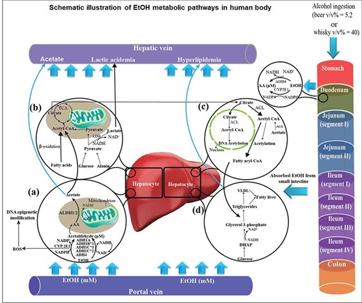 Schematic illustration of ethanol (EtOH) destination in human body after ingestion of alcoholic beverages. (a) EtOH is oxidized to acetaldehyde in hepatocytes through alcohol dehydrogenases (ADH1A, ADH1B*1, ADH1C*1 and ADH4) and cytochrome P450 2E1 (CYP2E1). Reactive oxygen species (ROS) are generated due to the interference of EtOH with electron transport complexes in mitochondrial membrane. Acetaldehyde is converted to acetate by aldehyde dehydrogenases (ALDH1/2). (b) Acetate is metabolized to acetyl CoA, which is considered as an important metabolic intermediate of the tricarboxylic acid (TCA) cycle and β-oxidation of fatty acids. (c) Citrate could be converted to acetyl CoA by ATP citrate lyase (ACL). The generated acetyl CoA may result in DNA acetylation or be involved in fatty acyl CoA production. (d) Fatty acyl CoA is associated with lipogenesis reactions, which results in triglycerides, very low density lipoproteins (VLDL) and, finally, alcoholic fatty liver in chronic alcoholic patients. The excess amount of EtOH in chronic alcoholic patients may result in elevated acetate in blood, lactic acidemia and hyperlipidemia.