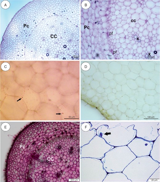 Anatomy and histochemistry of Utricularia reniformis stolons. (A, B) General stolon anatomy. Note the parenchymatous cortex (Pc), which surrounds the ectophloic central cylinder (CC). pf, phloem; x, xylem. Scale bar = 100 µm. (C) Reaction for lipids (Sudan IV). Arrows indicate small lipid droplets. Scale bar = 50 µm. (D) Section after IKI treatment. Note the lack of starch grains. Scale bar = 100 µm. (E) Section treated with ruthenium red for pectins and mucilage. Note the positive pectin reaction in cell walls. Scale bar = 200 µm. (F) Semithin section. Note the giant vacuoles and the nucleus with paracrystalline protein inclusions. Scale bar = 20 µm.