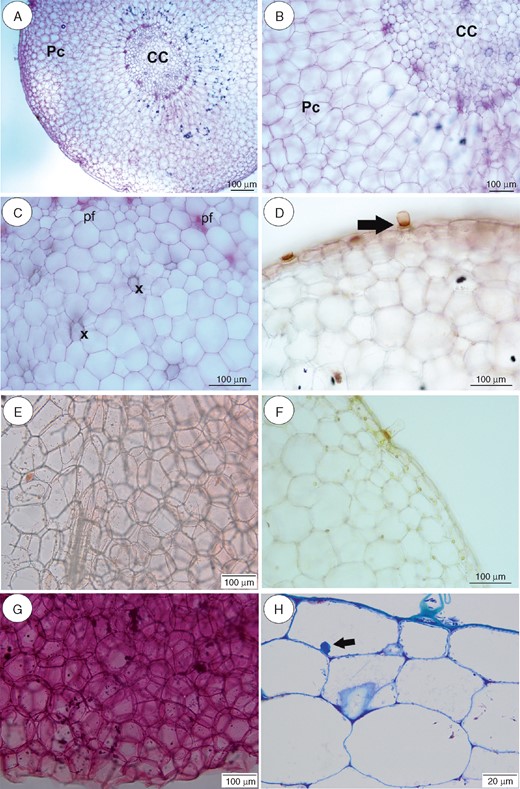 Anatomy and histochemistry of Utricularia geminiloba tubers. (A–C) General tuber anatomy. Note the parenchymatous cortex (Pc), which surrounds the ectophloic central cylinder (CC). pf, phloem; x, xylem. Scale bar = 100 µm. (D) Reaction for lipids (Sudan IV). Note positive reaction in barrier cell of the trichome (arrow). Scale bar = 100 µm. (E) Reaction for lipids (Sudan IV). Scale bar = 100 µm. (F) Section after IKI treatment. Note the lack of starch grains, but the positive reaction for protein in the nuclei and trichome. Scale bar = 100 µm. (G) Section treated with ruthenium red for pectins and mucilage. Note (arrow) the positive pectin reaction in cell walls. Scale bar = 100 µm. (H) Semithin section. Note the giant vacuoles and the nucleus with paracrystalline protein inclusion. Scale bar = 20 µm.