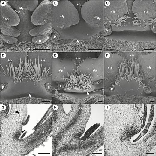 Nectary gland development in Geranium pratense. (A–F) Micrographs obtained using scanning electron microscopy. (G–I) Longitudinal sections. (A) Base of the antesepalous stamen before insertion of the nectary gland. (B) First bulging of the developing gland. The arrow indicates the first bulging of nectary gland tissue. (C) Formation of the anthophore and onset of trichome development. (D) Onset of nectarostomata development. The arrow is pointing to one nectarostoma. (E) Onset of development of circular constriction of the anthophore. The arrow is pointing to one nectarostoma. (F) Nectary gland at anthesis. (G) Longitudinal section through the state corresponding to (B). The arrow indicates developing glandular tissue. (H) Longitudinal section through the state corresponding to (C). (I) Section through an almost anthetic flower. Perianth organs removed. p, petal; s, sepal; stP, antepetalous stamen; stS, antesepalous stamen. Scale bars in (A–I) = 100 μm.