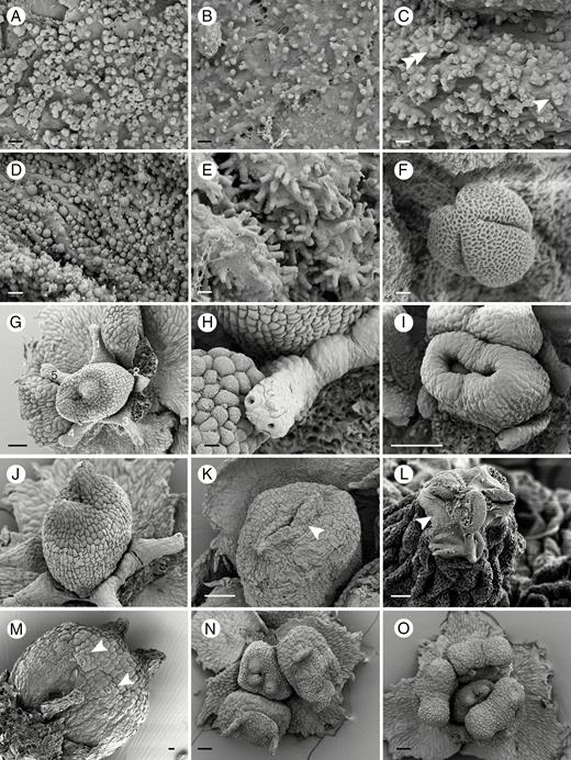 Details of anthers and floral structures of Ophiocaryon. (A, F) O. paradoxum; (B, G, N, O) O. heterophyllum; (C) O. duckei; (D) O. klugii; (E, L) O. maguirei; (K, M) O. manausense. (A) Oval-shaped orbicules with central compression situated on the inner anther wall. (B) Polygonal-shaped orbicules. (C) Mixture of oval-shaped orbicules with central compression (arrowhead) and polygonal shaped orbicules (double arrowhead). (D) Spherical-shaped orbicules. (E) Rod-shaped orbicules. (F) A pollen grain with three grooves and reticulate ektexine. (G) Narrow nectar disc with five appendages surrounding the ovary. (H) A nectary appendage with two stomata. (I) A young ovary comprising two horseshoe-shaped carpels that fuse congenitally at the base. (J) Ovary with rough-celled style and stigmatic area surface and smooth lower surface. (K) Ovary with horizontally appressed style (arrow). (L) Tip of stigma with pollen grains glued by exudate (arrow). (M) Stomata on ovary wall (arrows). (N) A flower with three-carpellate ovary. (O) A flower with three fertile stamens and two staminodes. Scale bars: (A–E) = 1 μm; (F) = 2 μm; (G, I, L, N, O) = 100 μm; (H, J, K) = 20 μm; (M) = 10 μm.