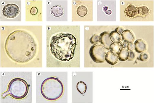Spheroid psilate (A–I) and confusers (J–L). (A–D, F–H) From surface samples and archaeological sites in West and Central Africa. (C, F–H) With corrosion features. (E) Elodea canadensis (Hydrocharitaceae), stem. (I) Parinari curatellifolia (Chrysobalanaceae), fruit. (J, K) Chrysophyte cyst, agricultural feature, Hawaii, Late Holocene. (L) Chrysophyte cyst, Palaeolake sediments, Northern Awash, Ethiopia, Late Pliocene. Authors: K. Neumann (A–D, F–I); C. Yost (E, J–L).