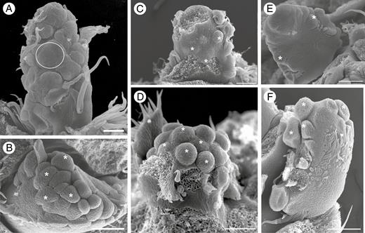 Intermediate developmental stages of inflorescence of Maclura tinctoria (A, B), Clarisia ilicifolia (C, D) and Morus nigra (E, F). (A) Asynchronous initiation of floral staminate meristems (ellipse). (B) Asynchronous initiation of several floral pistillate meristems (asterisks). (C) Receptacle of staminate inflorescence with asynchronously emerging simple or peltate interfloral bracts (asterisks). (D) Inflorescence with several developing pistillate flowers (asterisks). (E) Initiation of floral staminate meristems on the sides of the receptacle (asterisks). (F) Initiation of floral pistillate meristems on the lateral surface of the receptacle (asterisks). Scale bars: (A) = 200 μm; (B) = 50 μm; (C–F) = 100 μm.