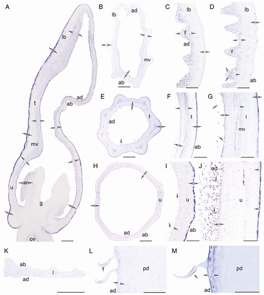 In situ hybridization of AfimWIN1. (A) Sagittal section of the Aristolochia fimbriata flower at S6; note higher expression in the adaxial perianth mesophyll, the fimbriae and the abaxial epidermis of the perianth. (B–D) Transverse (B) and longitudinal (C, D) sections of the limb at low (B), mid- (C) and high (D) magnification. (E–G) Transverse (E) and longitudinal (F, G) sections of the tube at low (E), mid- (F) and high (G) magnification. (H–J) Transverse (H) and longitudinal (I–J) sections of the utricle at low (H), mid- (I) and high (J) magnification. (K) Transverse section of the leaf. (L–M) Longitudinal section of the floral pedicel (L) and detail of its hooked trichomes (M). Arrow/bar signs point to tissue with positive expression; ab, abaxial epidermis; ad, adaxial epidermis; an, anther; fi, fimbriae; g, gynostemium; l, leaf; lb, limb; mv, midvein; ov, ovary; pd, pedicel; t, tube; u, utricle. Scale bars: 100 µm (A, B, E, H); 150 µm (C, F, I); 200 µm (D, G, J); 60 µm (K–M).