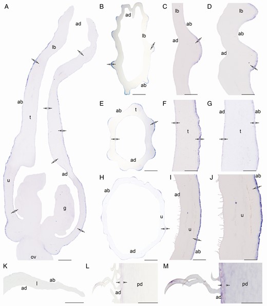In situ hybridization of AfimHDG2. (A) Sagittal section of the Aristolochia fimbriata flower at S6; note expression in the abaxial epidermis of the perianth, and weak expression in its adaxial counterpart. (B–D) Transverse (B) and longitudinal (C, D) sections of the limb at low (B), mid- (C) and high (D) magnification. (E–G) Transverse (E) and longitudinal (F, G) sections of the tube at low (E), mid- (F) and high (G) magnification. (H–J) Transverse (H) and longitudinal (I–J) sections of the utricle at low (H), mid- (I) and high (J) magnification. (K) Transverse section of the leaf. (L–M) Longitudinal section of the floral pedicel (L) and detail of its the hooked trichomes (M). Arrow/bar signs point to detailed expression patterns; ab, abaxial epidermis; ad, adaxial epidermis; fi, fimbriae; g, gynostemium; l, leaf; lb, limb; mv, midvein; ov, ovary; pd, pedicel; t, tube; u, utricle. Scale bars: 100 µm (A, B, E, H); 150 µm (C, F, I); 200 µm (D, G, J); 60 µm (K–M).