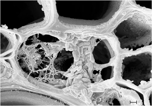 Scanning electron micrograph of a xylem vessel from grape (Vitis vinifera) showing typical vascular occlusions caused by Xylella fastidiosa cell aggregates and excretion products. Bacteria are visible as oval-shaped cells along the right side of the vessel in the centre of the image, with carbohydrate excretions visible as tangled masses on the left side of the vessel. Scale bar: 1 µm. Image courtesy of Eduardo Alves (Universidade Federal de Lavras, Brazil).