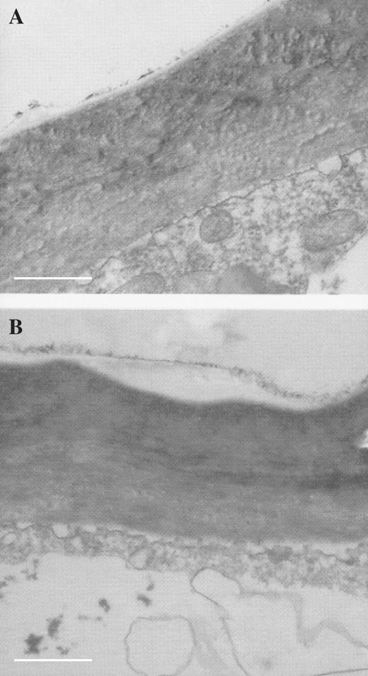 TEM sections through outer wall of patch papilla (A) and typical labellar papilla (B), respectively, showing diffuse, osmiophilic material associated with outer cell wall. Scale bars = 1 μm.