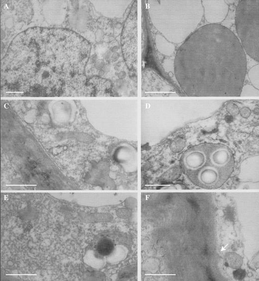 (A) TEM section of patch papilla showing nucleus, vacuolar profiles, proplastids and mitochondria. Scale bar = = 1 μm. (B) A similar section of a patch papilla showing proplastids with few internal lamellae and numerous vacuolar profiles. Scale bar = 1 μm. (C) TEM section of patch papilla showing plasmalemma, proplastids, amyloplasts, mitochondria and tonoplast. Scale bar = 1 μm. (D) TEM section of patch papilla showing amyloplast with starch grains, mitochondria and vacuolar profiles. Note also the osmiophilic, lipid bodies. Scale bar = 1 μm. (E) A similar section showing dense, rough endoplasmic reticulum, mitochondria, amyloplast and osmiophilic, lipid bodies. Scale bar = 1 μm. (F) Detail of cell wall of patch papilla with small ingrowths (arrow). Note also the dictyosome and lipid bodies in the parietal cytoplasm. Scale bar = 1 μm.