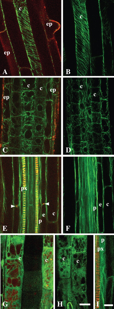 Cortical microtubule array and actin cytoskeleton in Arabidopsis roots in relation to application of NR. (A and B) Cortical microtubules in GFP-MAP4 roots; cortical cells of the young differentiated zone in roots stained with 1 μm NR (A) and without staining (B). (C–F) Actin cytoskeleton in GFP-ABD2 roots; the cells of the transition zone (C and D) and differentiation zone (E and F) stained with 1 μm NR (C and E) and without staining (D and F). (G–I) Actin filaments in GFP-mTn line, in the transition zone (G and H) and pericycle adjacent to protoxylem within the differentiation zone (I) stained with 4 μm (G), 1 μm (I) or without staining (H). All panels are single optical sections. (A–D, G and H) Tangential longitudinal optical sections; (E, F and I) longitudinal median optical sections of roots positioned in the protoxylem plane. Staining time was 30–60 min. Arrowheads indicate Casparian band. ep, Epidermis; c, cortex; e, endodermis; p, pericycle; px, protoxylem. In all cases pH of NR solution was 5·8. Scale bars: H and I = 20 μm. Magnification on panels (A–H) is the same.