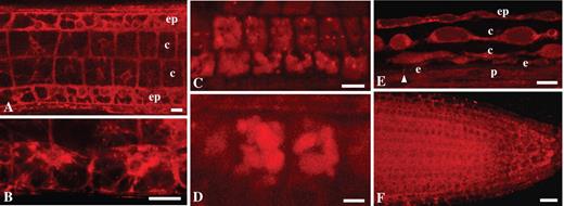 Staining properties of NR at pH 8·0 prepared in solutions of different ionic strength in arabidopsis Col-0 (A–D and F) and Ler (E) wild-type plants: (A) tangential longitudinal section, showing staining of cytoplasm in epidermis and cortex in the transition zone; (B) staining of cytoplasm in the epidermis in the transition zone; (C and D) vacuolar system in the cortical cells of the transition zone; (E) vacuolar system in the differentiation zone shown in partially tangential section; (F) staining of cytoplasm in near-median section of the root apical meristem. The arrowhead indicates Casparian bands. ep, Epidermis; c, cortex; e, endodermis; p, pericycle. Roots were stained with 4 μm (A–E) or 0·4 μm (F) NR. The staining solution was prepared in 0·2× MS supplemented with 20 mm K-phosphate buffer (A), in 0·1 m K-phosphate buffer (B and F), in 0·2× MS supplemented with 20 mm K-phosphate buffer and 50 mm KNO3 (C and D) and in 1 m K-phosphate buffer (E). Staining time was 15–30 min (A–E) and 1 h (F). Single optical sections (A, E and F) and projection of three optical sections, total thickness of tissues scanned is 2·4 μm (B), projection of three optical sections, total thickness of tissues scanned is 2·6 μm (C), and projection of six optical sections, total thickness of tissue scanned is 5 μm (D). Scale bars: A, B, E and F = 20 μm; C = 10 μm; D = 5 μm.